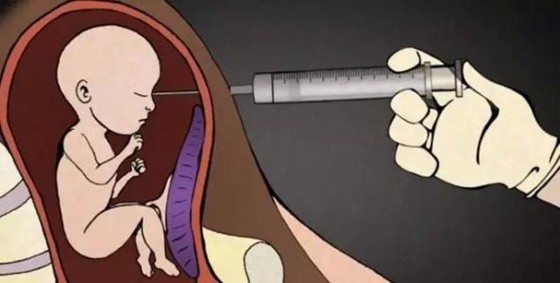 试管婴儿怀孕的4大注意事项，它与自然怀孕是一样的