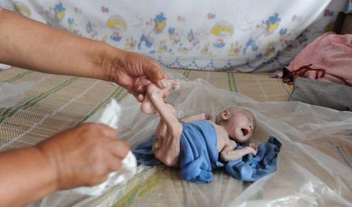 泰国合法试管婴儿价格-在泰国进行试管婴儿治疗有什么优势？