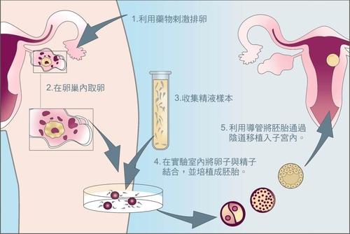 泰国合法供卵包生男孩:胚胎为什么在NIC试管婴儿中心做泰国试管婴儿感觉很舒服。