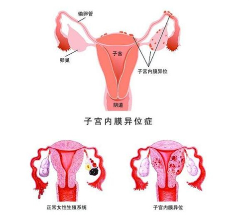 杭州助孕中心排名-江苏省哪些试管婴儿医院的成功率高？江苏试管婴儿的成功率是多少？